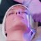 Light Therapy for Acne – Better Days Ahead?