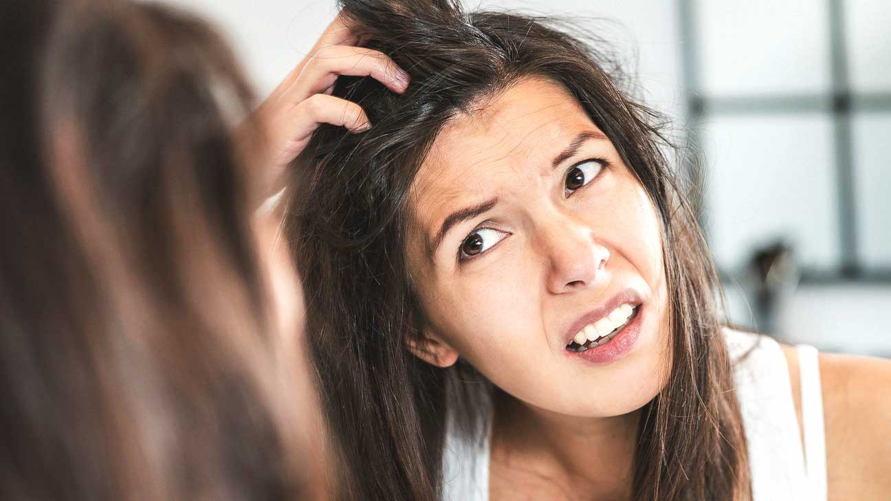 Best Natural Ways to Remove Dandruff From Your Scalp